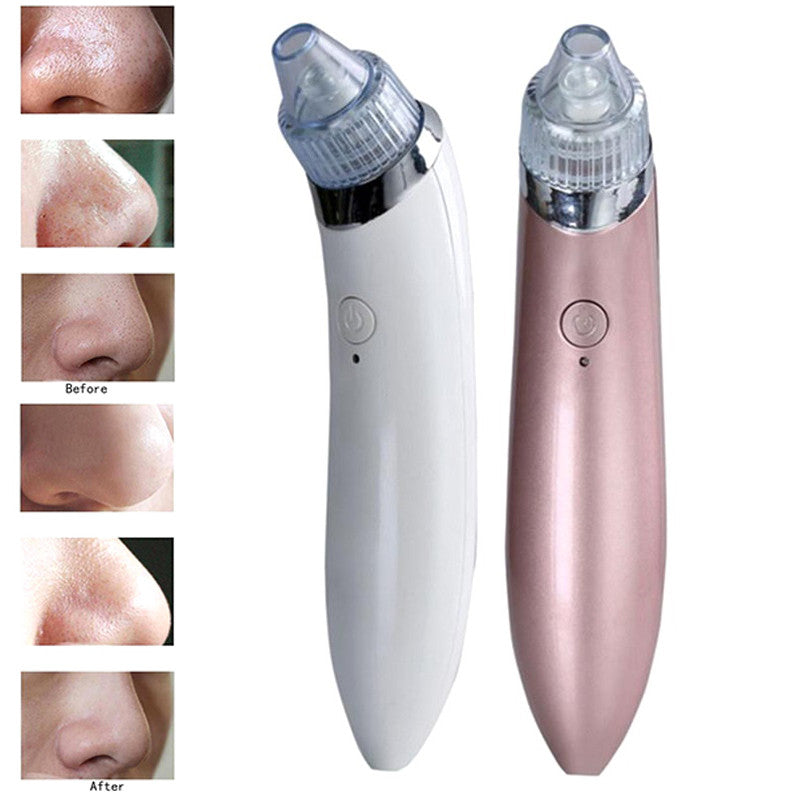 Blackheads Suction Instrument Electric Microcrystal To Blackheads Beauty Instrument