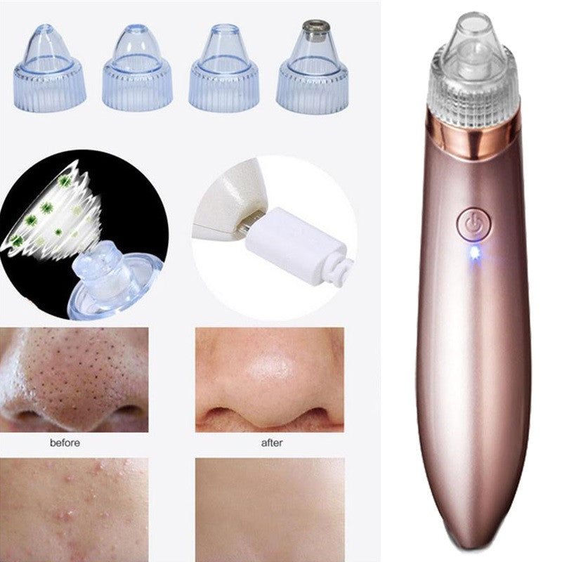 Blackheads Suction Instrument Electric Microcrystal To Blackheads Beauty Instrument